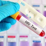 Hopes Of HIV Cure After Breakthrough Using Gene-editing 'Scissors'