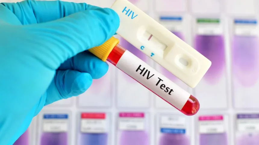 Hopes Of HIV Cure After Breakthrough Using Gene-editing 'Scissors'