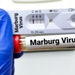 Africa CDC Launches Immediate Response To Tanzania Amid Marburg Virus Outbreak