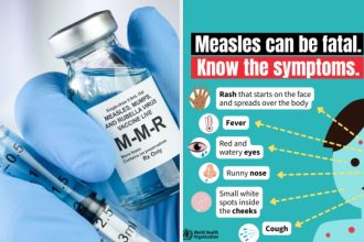 Global Measles Deaths Drop 88% Since 2000, But Cases Surge