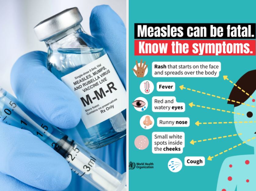 Global Measles Deaths Drop 88% Since 2000, But Cases Surge
